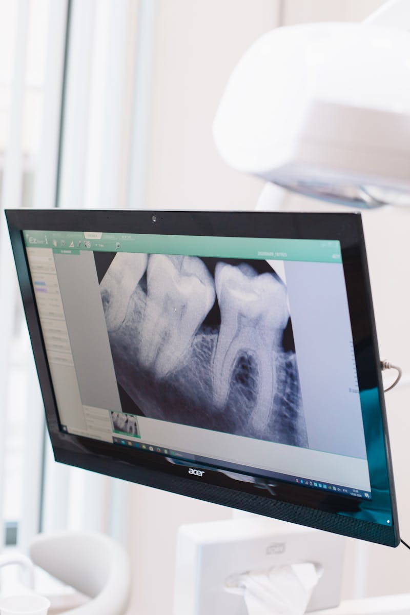 Failed dental work assessment
