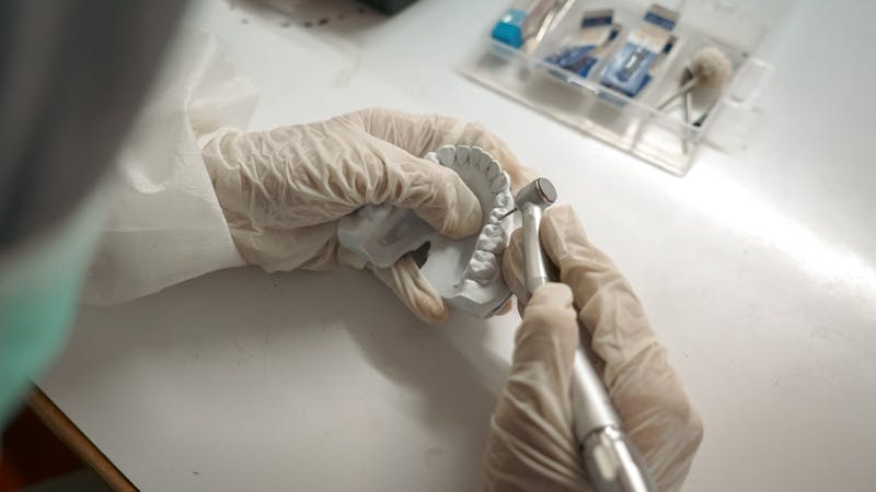 Implant prosthetics