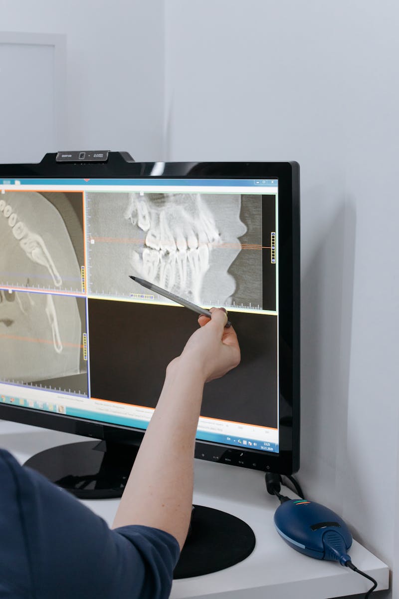 Root canal