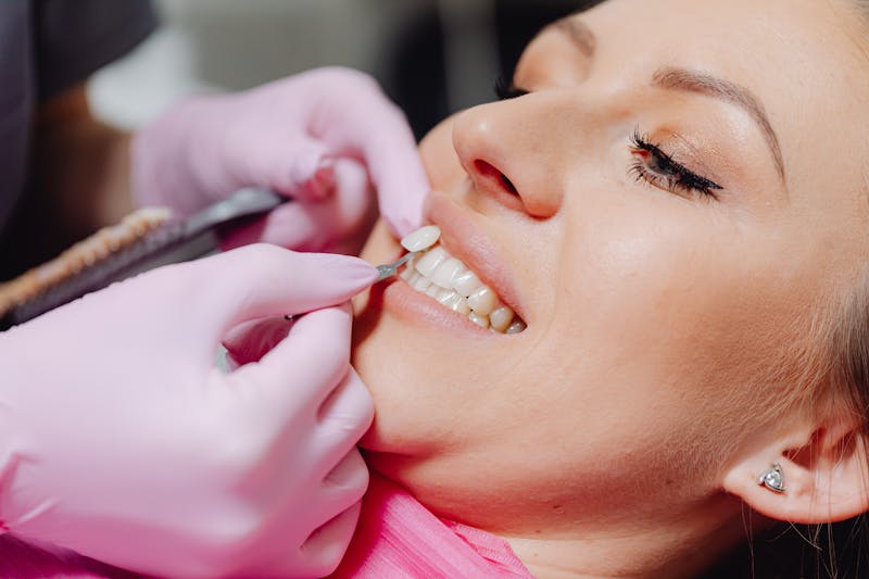 Teeth whitening